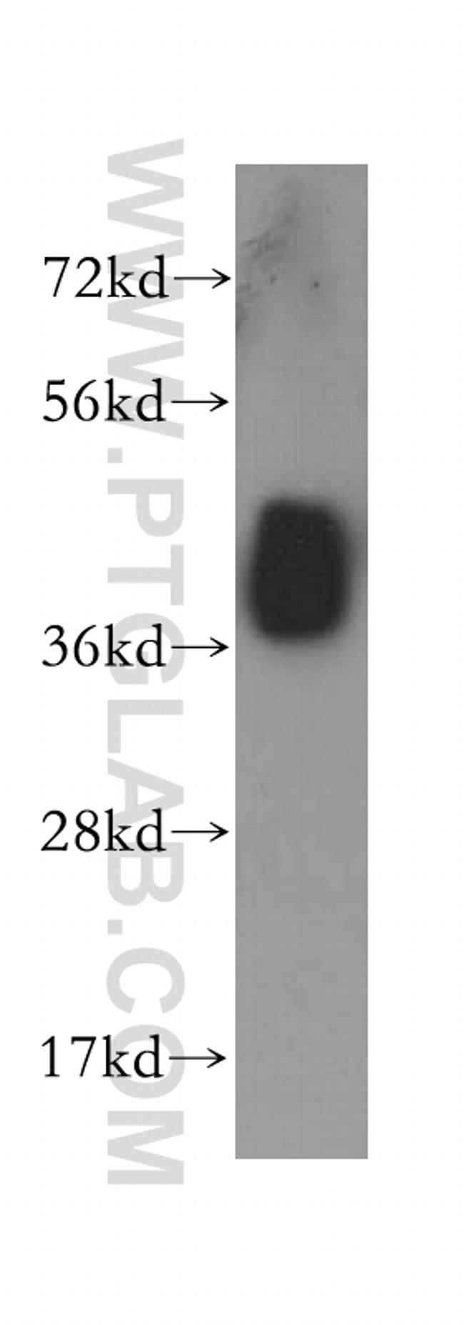 ALDOA Antibody in Western Blot (WB)