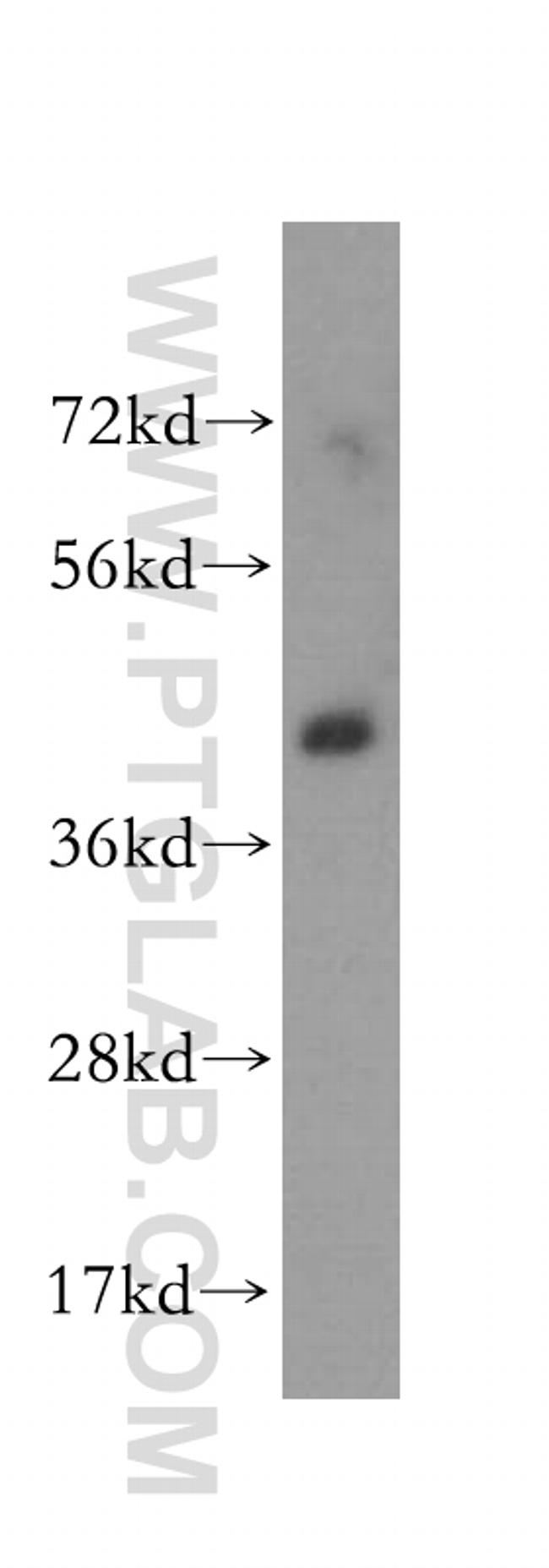 ALDOA Antibody in Western Blot (WB)