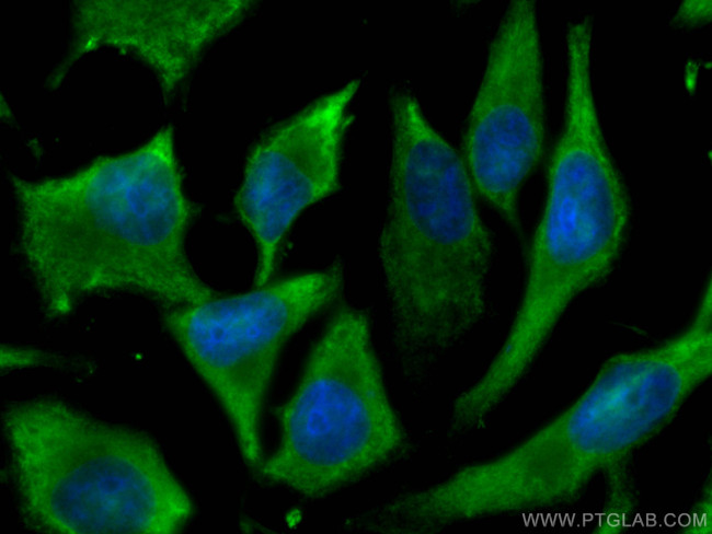 ALDOA Antibody in Immunocytochemistry (ICC/IF)