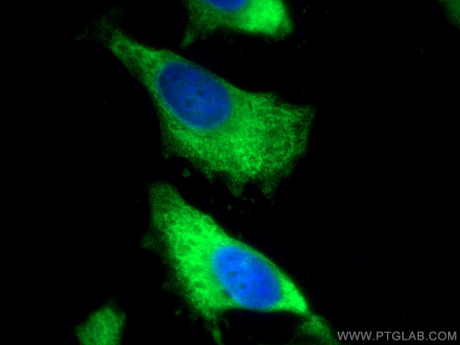 ALDOA Antibody in Immunocytochemistry (ICC/IF)