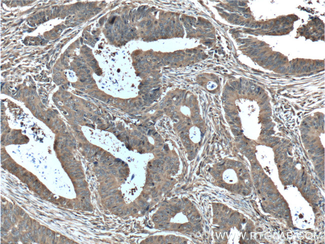 ALDOA Antibody in Immunohistochemistry (Paraffin) (IHC (P))