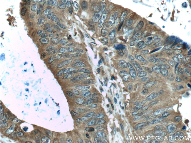 ALDOA Antibody in Immunohistochemistry (Paraffin) (IHC (P))