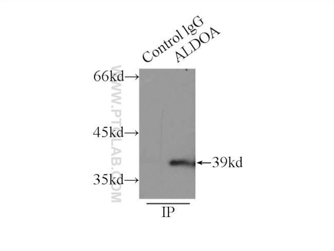 ALDOA Antibody in Immunoprecipitation (IP)