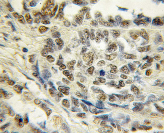 TCEAL7 Antibody in Immunohistochemistry (Paraffin) (IHC (P))