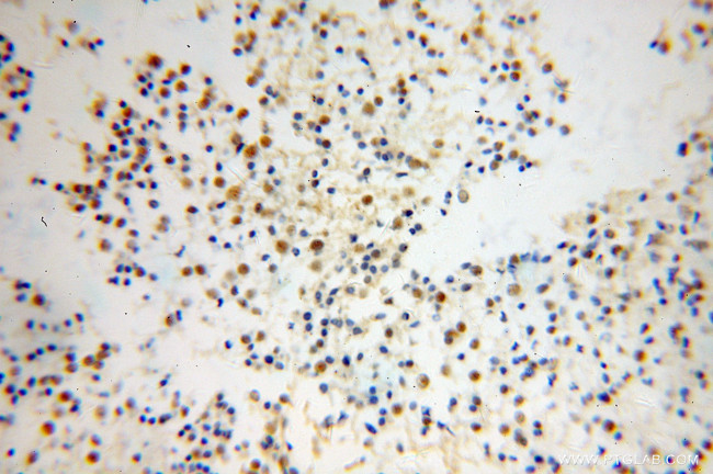 TCEAL7 Antibody in Immunohistochemistry (Paraffin) (IHC (P))