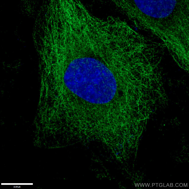 alpha Tubulin Antibody in Immunocytochemistry (ICC/IF)