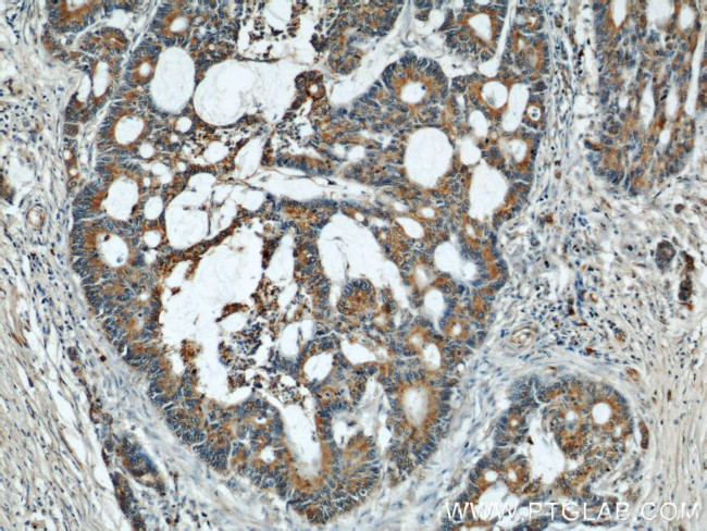 alpha Tubulin Antibody in Immunohistochemistry (Paraffin) (IHC (P))