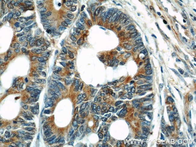 alpha Tubulin Antibody in Immunohistochemistry (Paraffin) (IHC (P))