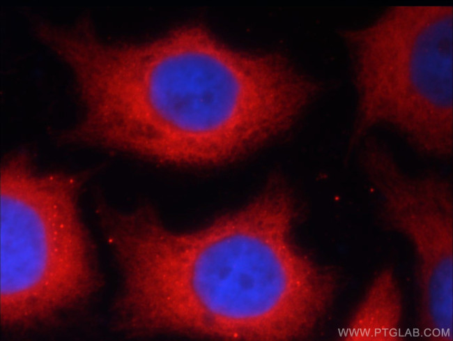 alpha Tubulin Antibody in Immunocytochemistry (ICC/IF)