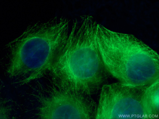 alpha Tubulin Antibody in Immunocytochemistry (ICC/IF)