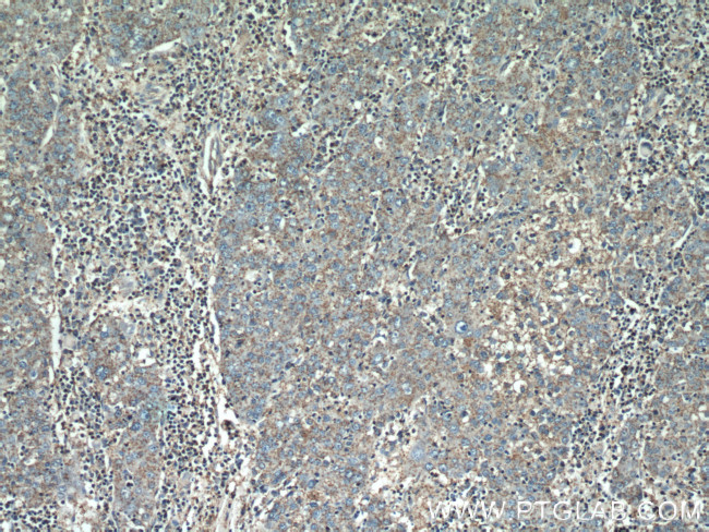 alpha Tubulin Antibody in Immunohistochemistry (Paraffin) (IHC (P))