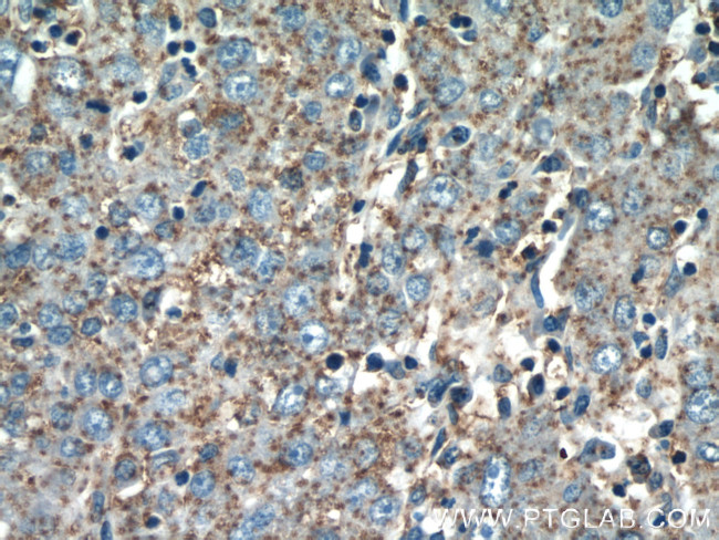 alpha Tubulin Antibody in Immunohistochemistry (Paraffin) (IHC (P))