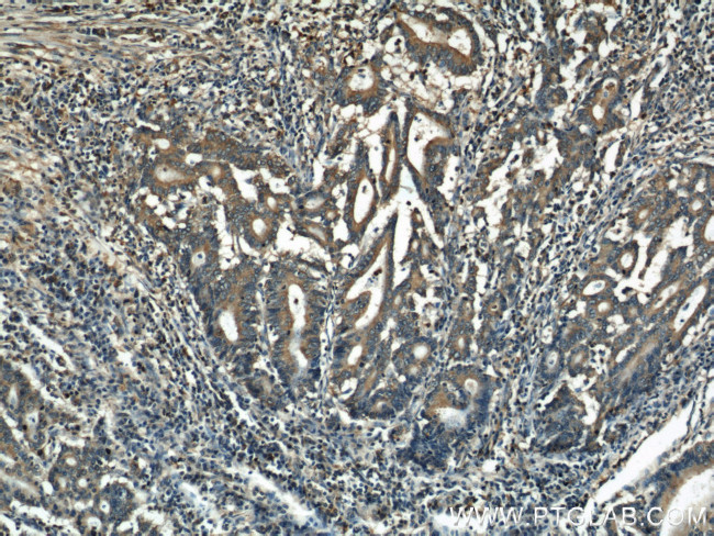 alpha Tubulin Antibody in Immunohistochemistry (Paraffin) (IHC (P))