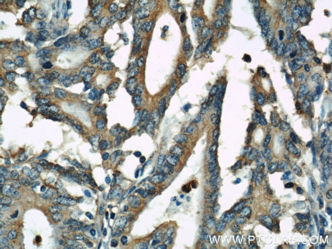 alpha Tubulin Antibody in Immunohistochemistry (Paraffin) (IHC (P))