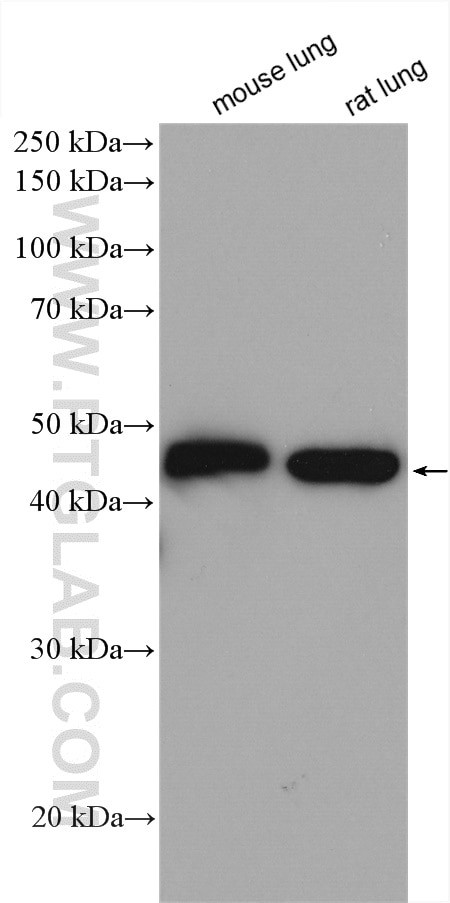 gamma Actin Antibody in Western Blot (WB)