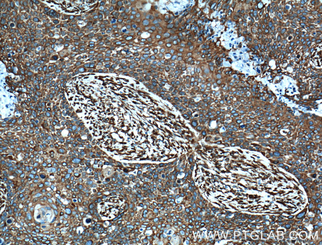 MAP4 Antibody in Immunohistochemistry (Paraffin) (IHC (P))