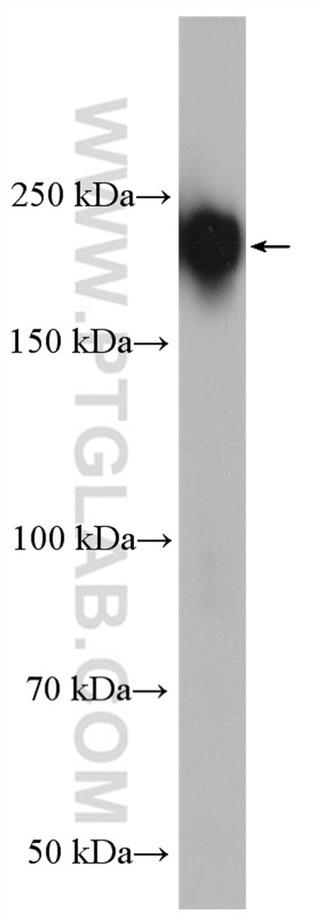 MAP4 Antibody in Western Blot (WB)