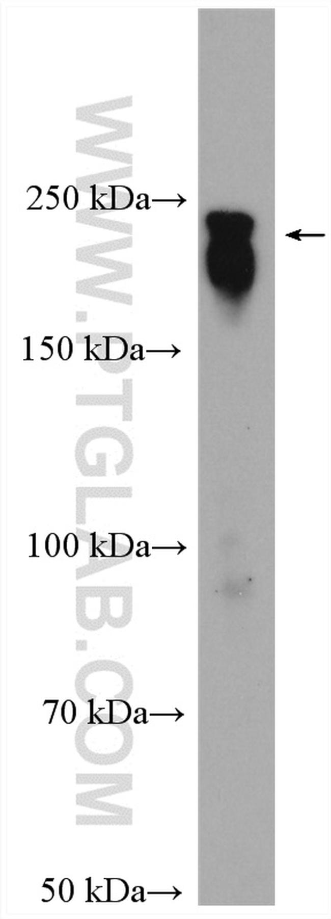 MAP4 Antibody in Western Blot (WB)