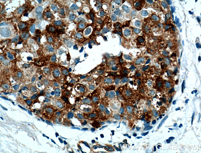 Casein Kinase 1 epsilon Antibody in Immunohistochemistry (Paraffin) (IHC (P))