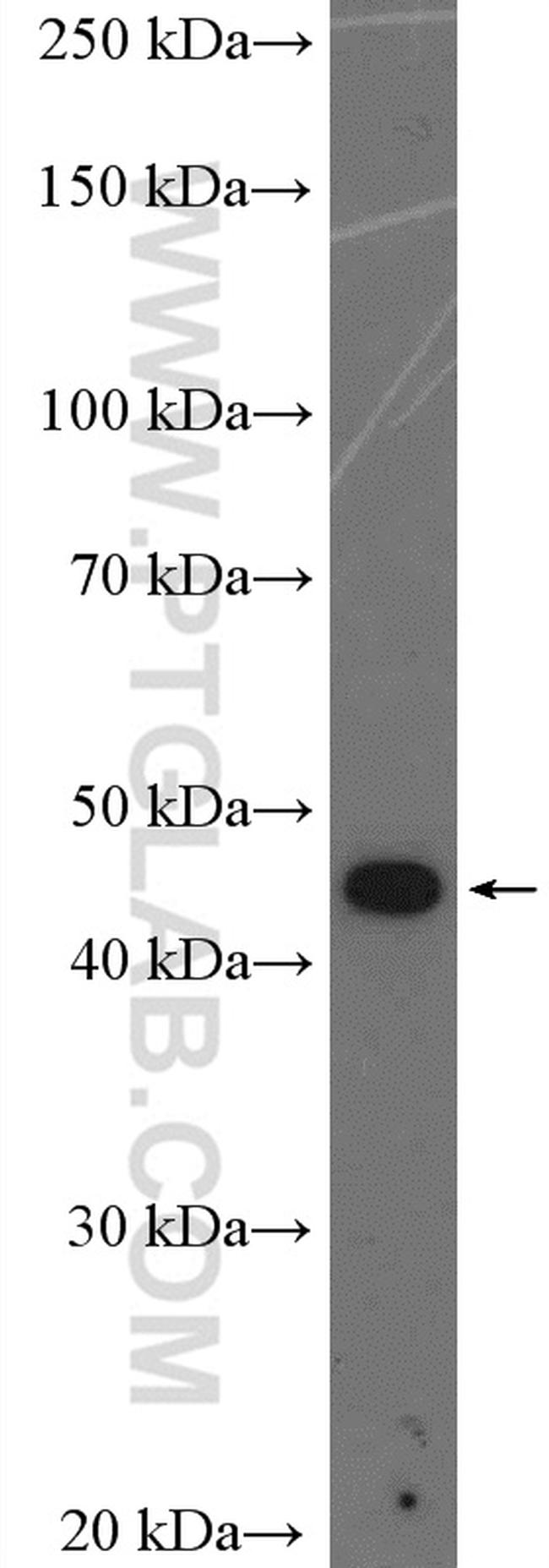 Casein Kinase 1 epsilon Antibody in Western Blot (WB)