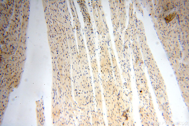 Casein Kinase 1 epsilon Antibody in Immunohistochemistry (Paraffin) (IHC (P))