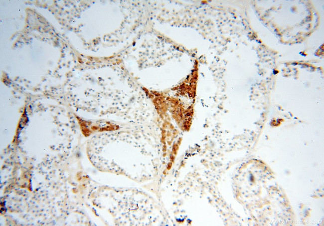 Casein Kinase 1 epsilon Antibody in Immunohistochemistry (Paraffin) (IHC (P))