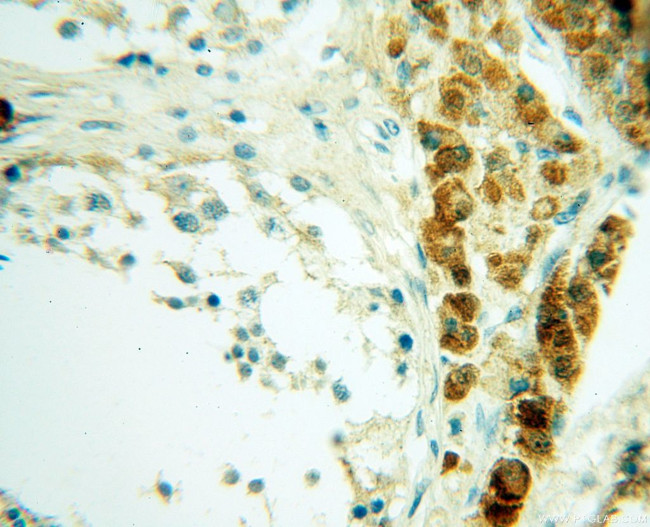 Casein Kinase 1 epsilon Antibody in Immunohistochemistry (Paraffin) (IHC (P))