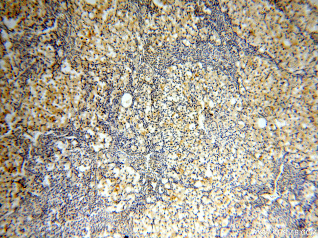 Casein Kinase 1 epsilon Antibody in Immunohistochemistry (Paraffin) (IHC (P))