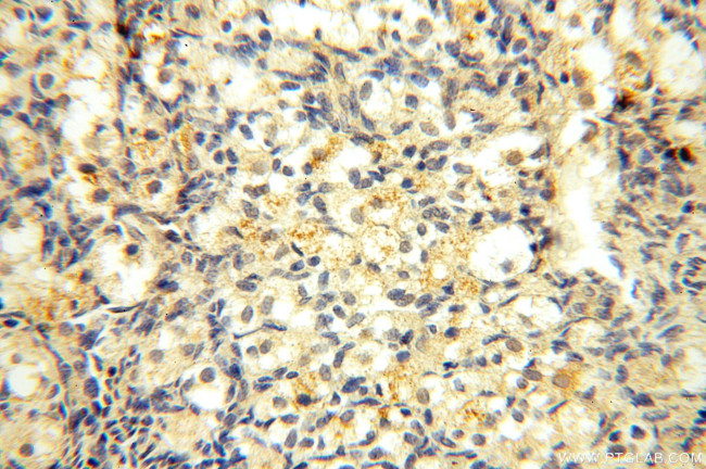 Casein Kinase 1 epsilon Antibody in Immunohistochemistry (Paraffin) (IHC (P))