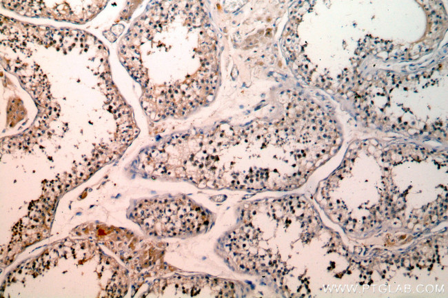 SETDB1 Antibody in Immunohistochemistry (Paraffin) (IHC (P))