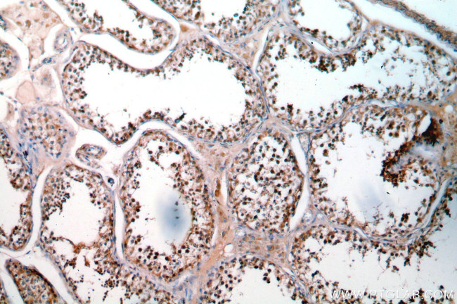 SETDB1 Antibody in Immunohistochemistry (Paraffin) (IHC (P))