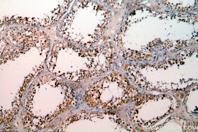 SETDB1 Antibody in Immunohistochemistry (Paraffin) (IHC (P))