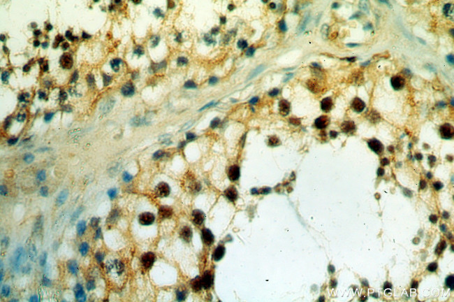 SETDB1 Antibody in Immunohistochemistry (Paraffin) (IHC (P))