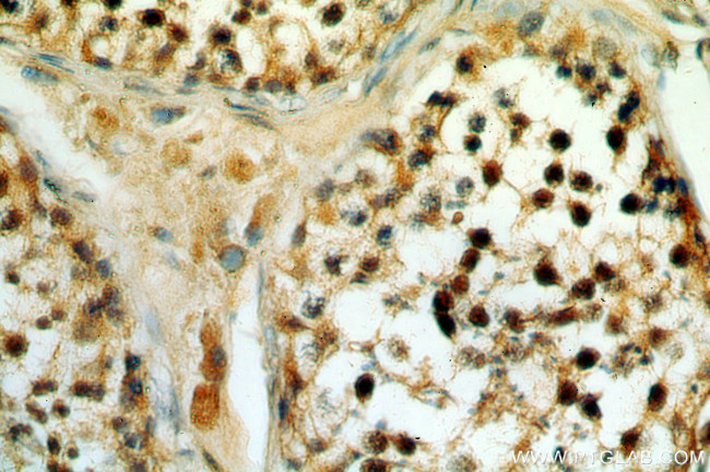 SETDB1 Antibody in Immunohistochemistry (Paraffin) (IHC (P))