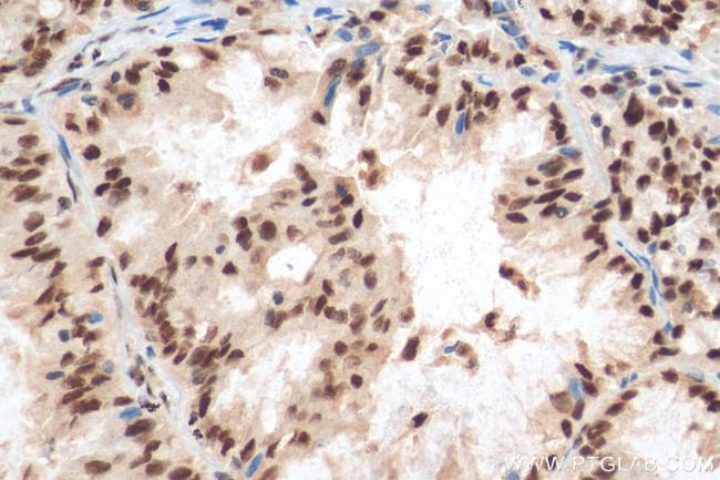 SETDB1 Antibody in Immunohistochemistry (Paraffin) (IHC (P))