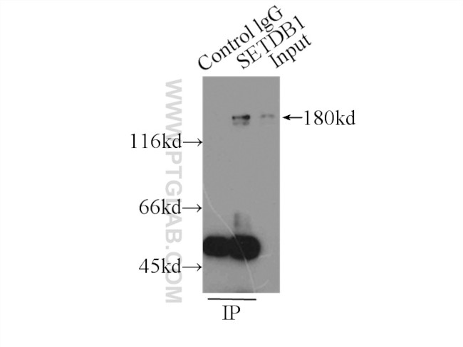 SETDB1 Antibody in Immunoprecipitation (IP)