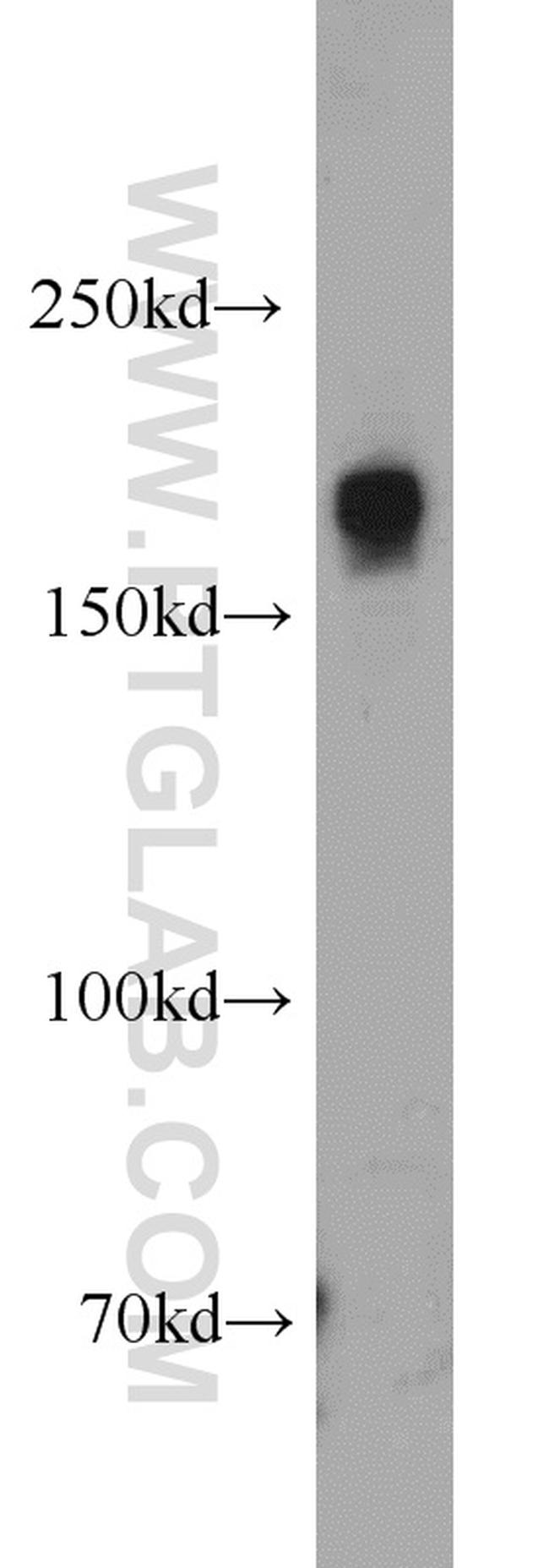 SETDB1 Antibody in Western Blot (WB)