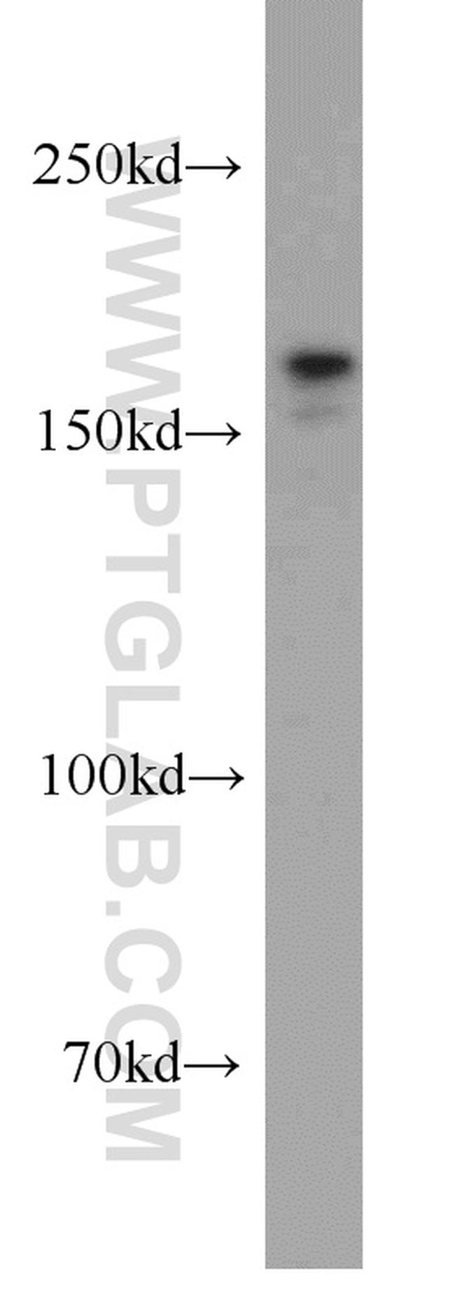 SETDB1 Antibody in Western Blot (WB)