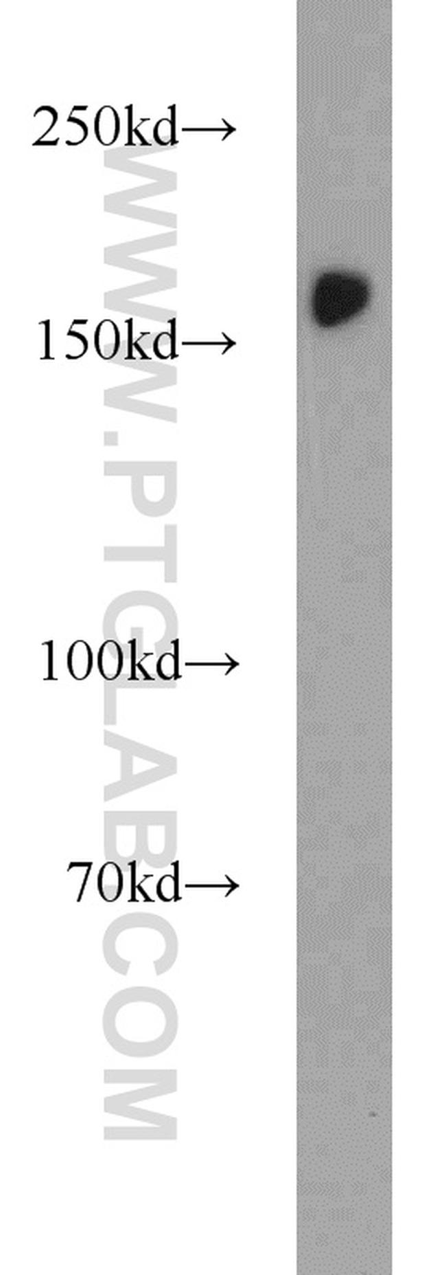 SETDB1 Antibody in Western Blot (WB)