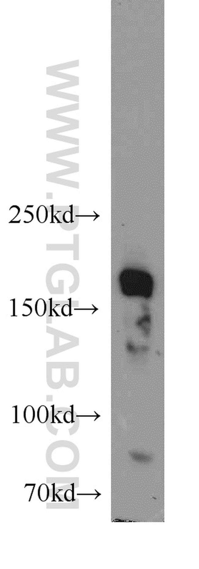 SETDB1 Antibody in Western Blot (WB)