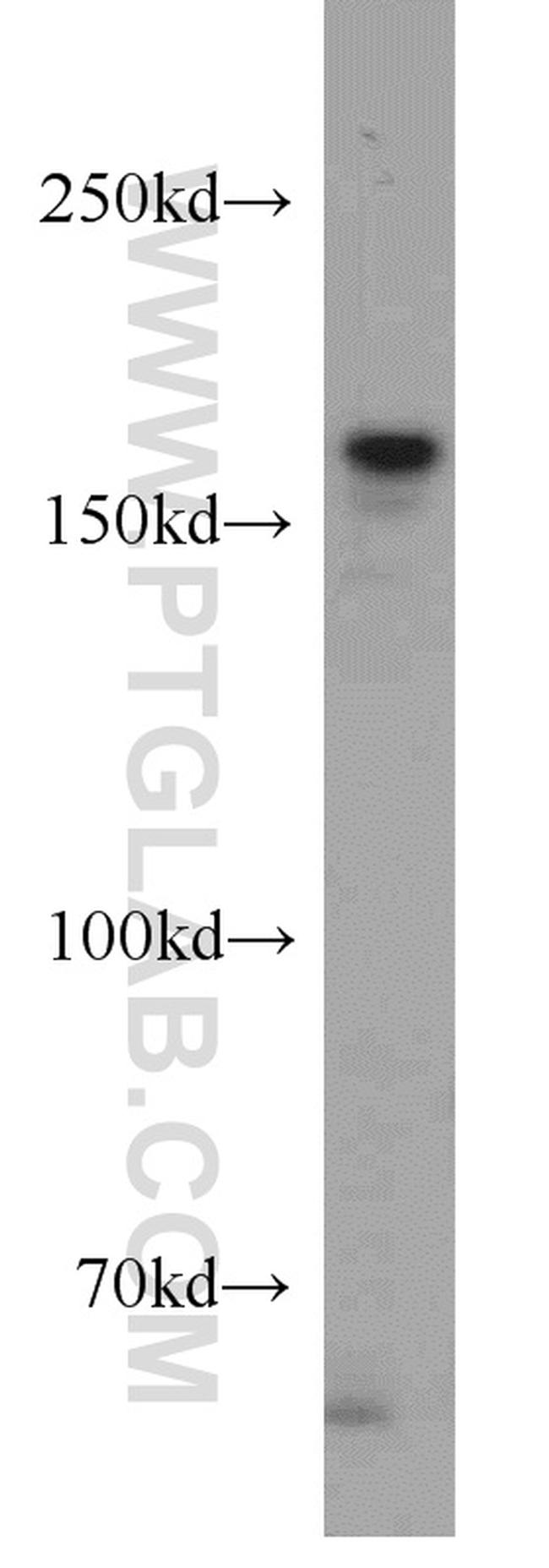 SETDB1 Antibody in Western Blot (WB)