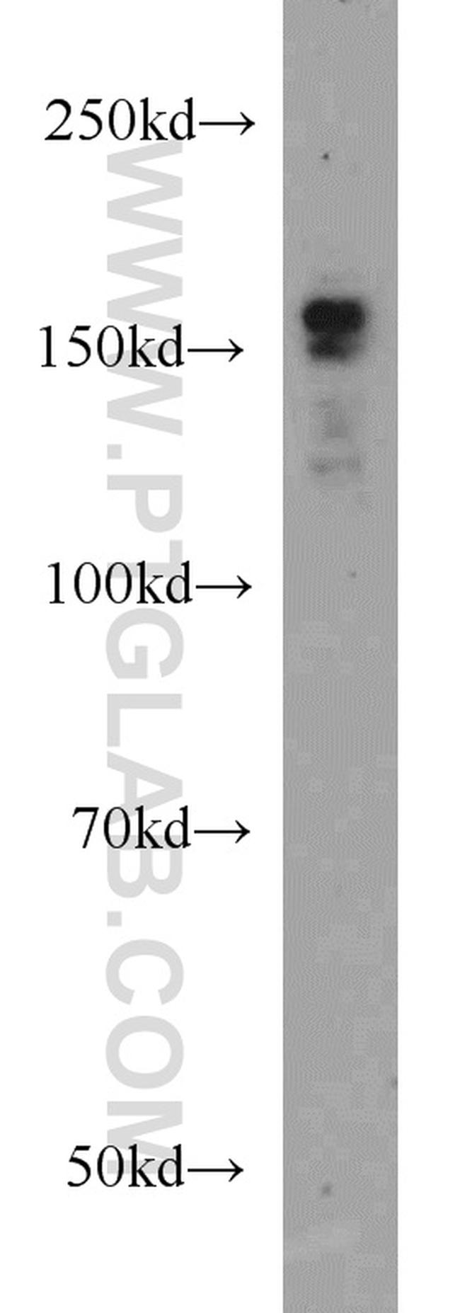 SETDB1 Antibody in Western Blot (WB)