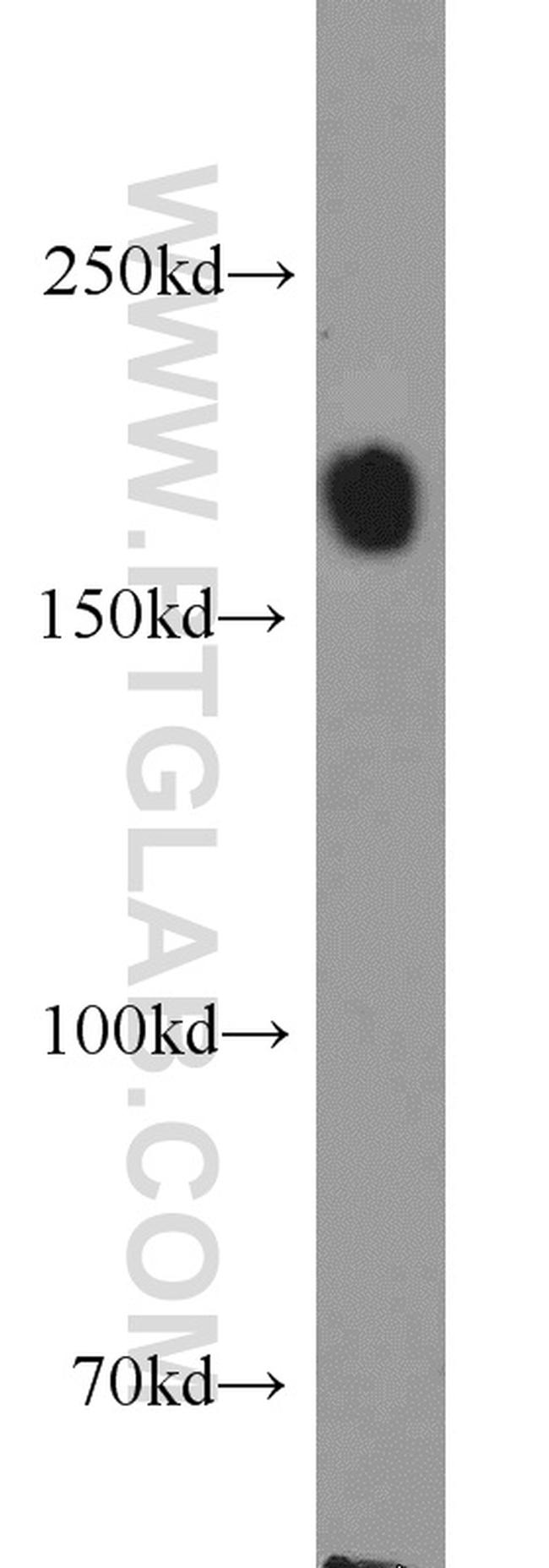 SETDB1 Antibody in Western Blot (WB)