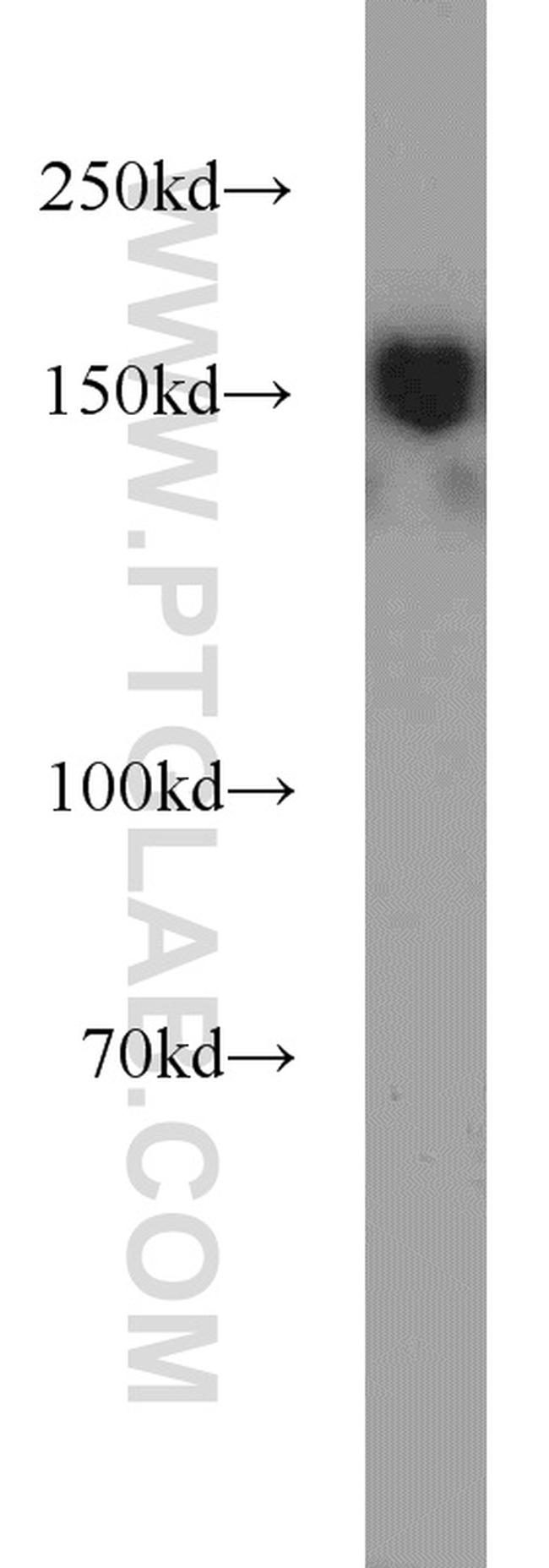 SETDB1 Antibody in Western Blot (WB)