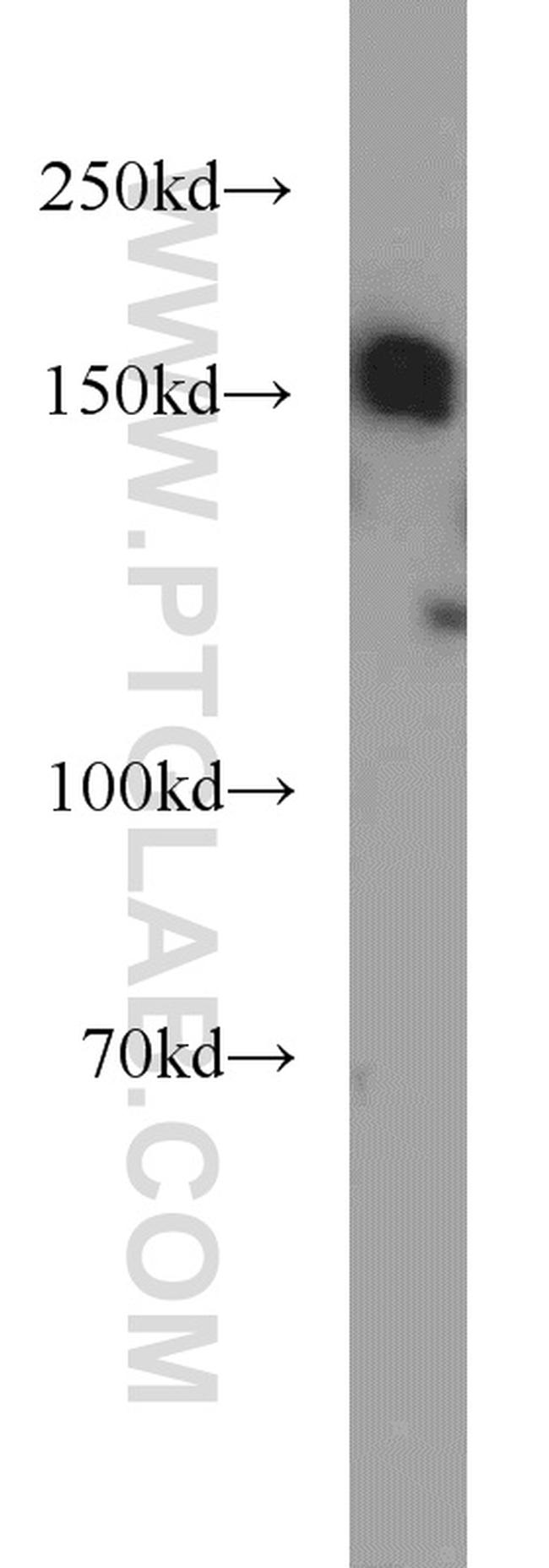 SETDB1 Antibody in Western Blot (WB)