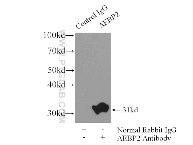 AEBP2 Antibody in Immunoprecipitation (IP)