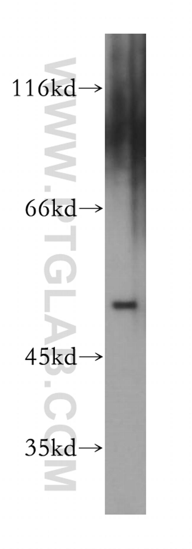 AEBP2 Antibody in Western Blot (WB)