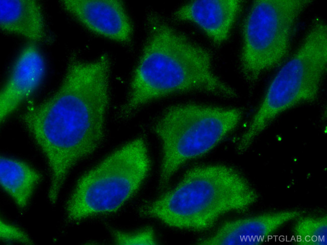 EIF2A Antibody in Immunocytochemistry (ICC/IF)