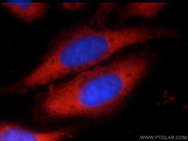 EIF2A Antibody in Immunocytochemistry (ICC/IF)