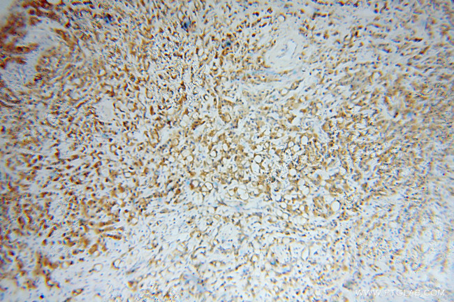 EIF2A Antibody in Immunohistochemistry (Paraffin) (IHC (P))